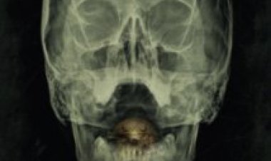 צפייה ישירה המפרץ | The Bay