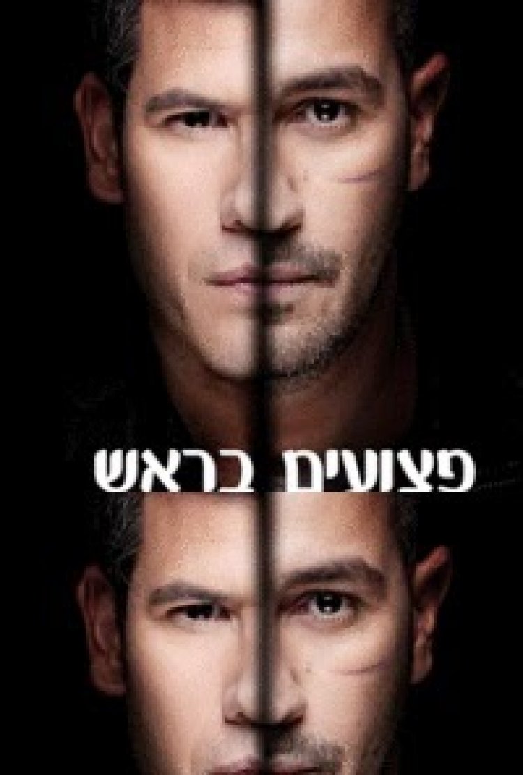 פצועים בראש עונה 1 פרק 3