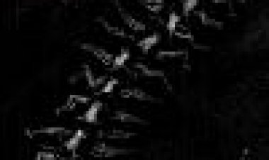 התולעת האנושית (החלק השני) כתובית | The Human Centipede II (Full Sequence) Subtitle