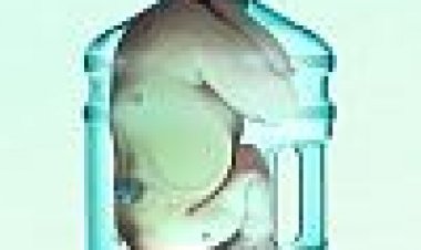 היפרפוטורה כתובית | Hyperfutura Subtitle